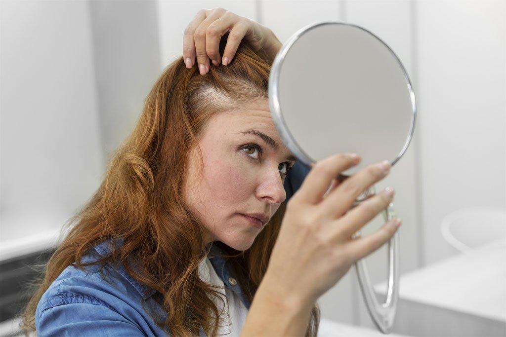 Hair Loss Service at Earls Barton Pharmacy