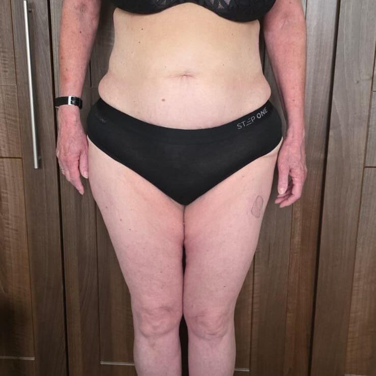 Slender-weight-loss